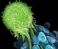 Cell Death Dis：腺瘤管状表皮细胞坏死性凋亡机制