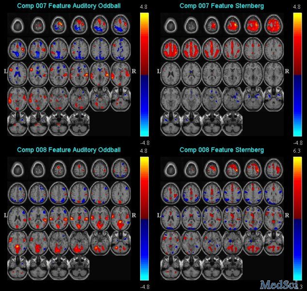 fMRI<font color="red">软件</font>统计方法有误，4万篇文献可能被中招！