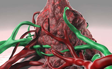 Science子刊：血液ctDNA测试早在确诊时就能预测结肠癌患者复发风险？