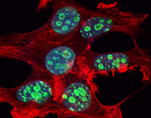 Nat Commun：特殊钙粘蛋白如何诱发癌细胞发生<font color="red">转移</font>？