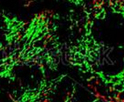 PLoS <font color="red">Biol</font>：线粒体特殊蛋白网络或可促进肿瘤细胞发生增殖转移