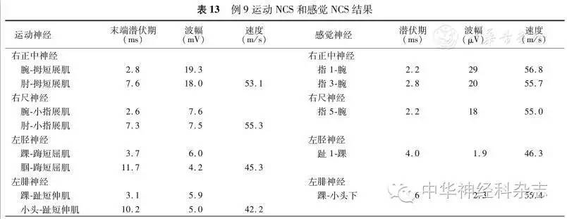 高频刺激见波幅递增,则符合lambert-eaton肌无力综合征的诊断