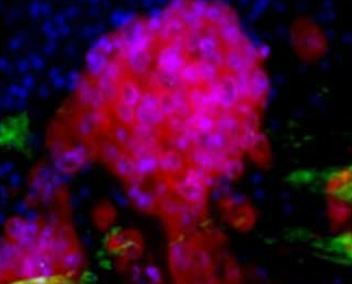 Nat Biotechnol：<font color="red">工程化</font>人类结肠组织模型或助力癌症研究