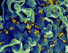 JAMA：大规模HIV传播研究表明：接受治疗的HIV患者或不会将病毒传播给伴侣对方