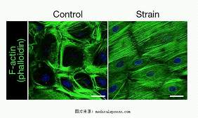 Nature子刊：干细胞可通过改变结构来对机械<font color="red">力</font>产生反应