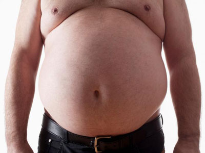 减肥手术不仅仅是减肥，还能逆转肥胖相关性早衰！