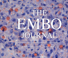 EMBO J：揭示特殊蛋白驱动<font color="red">免疫</font><font color="red">细胞</font>自杀的分子机理