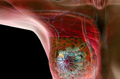 Oncogene：乳腺癌诊断新靶点