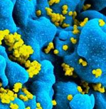 <font color="red">JVI</font>：首次利用CAR-T免疫疗法杀死被HIV感染的细胞