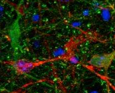 Nature子刊：揭示阿尔茨海默病<font color="red">毒性</font>蛋白tau在大脑中扩散机制