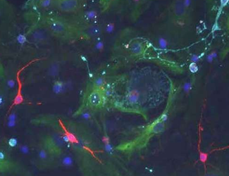 Cell Stem Cell：常被人<font color="red">忽视</font>的脉络丛竟能调控大脑中的神经干细胞