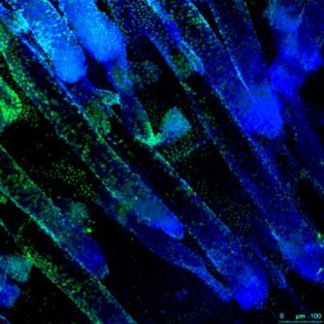 Cell Stem Cell：科学家找到维持皮肤干细胞功能的两个蛋白“守卫”