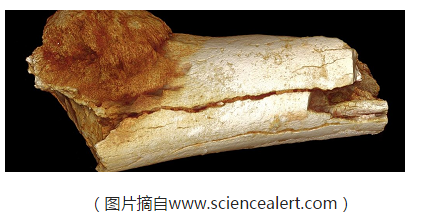 S African J Sci：化石证据表明癌症并不是现代<font color="red">社会</font><font color="red">的</font><font color="red">产物</font>