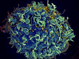 Nat Immunol：科学家开发出治疗HIV等<font color="red">长效</font>病毒感染的新<font color="red">疗法</font>