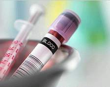EBioMedicine：鉴别出750多个生物<font color="red">标志物</font> 助力<font color="red">癌症</font>早期筛查