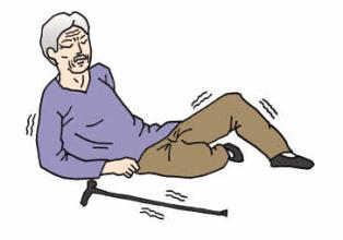 <font color="red">Int</font> J Epidemiol：运动干预可有效预防老年人跌倒相关骨折