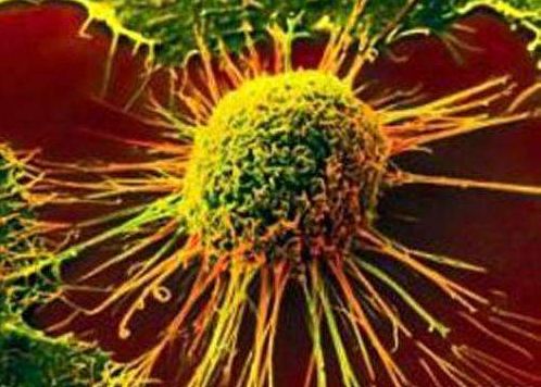 Lancet Oncol：科学家揭开癌症风险的复杂遗传奥秘