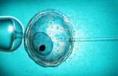 Fertil Steril：不明原因不孕症的最好治疗方法