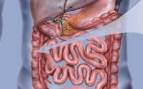 Am J Gastroenterol：brodalumab会导致活动性克罗恩病恶化