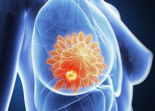 Cancer Res：癌蛋白信号动员炎症网络为乳腺癌脑转移提供合适微环境