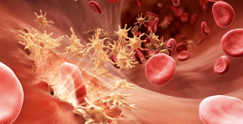 Blood：巨细胞病毒不能预防白血病的复发