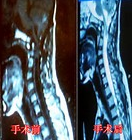 2016中国<font color="red">颅</font>颈交界区畸形诊疗专家共识发布