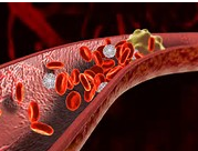 CHC 2016：快看阜外心<font color="red">血管病</font>专家如何用新型口服抗凝药