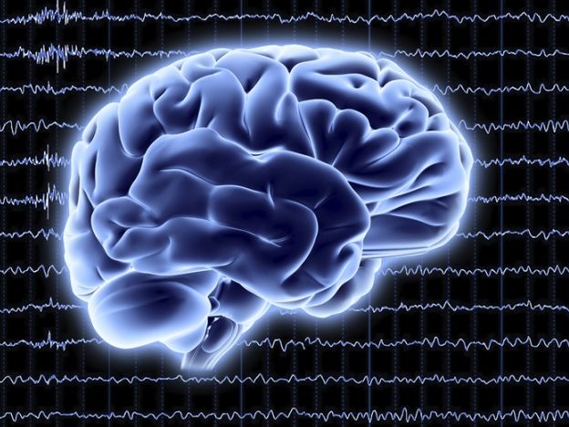 新型成像技术或可对大脑化学信号实现实时监测