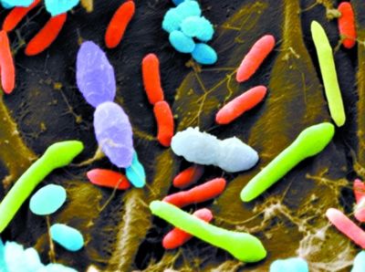 科学家开发工程细菌靶向肠道菌群降体重