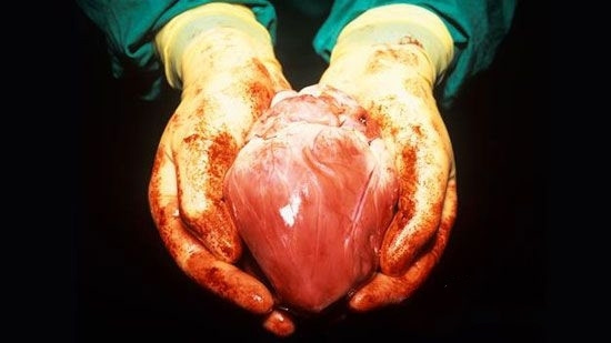 2015心脏外科手术血液管理专家共识发布