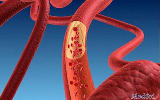 Circulation：急性冠状动脉综合征后与患家族性高胆固醇血症的患者预后依然较差