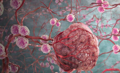 PNAS：科学家构建肿瘤“进化树”，解析癌转移机制