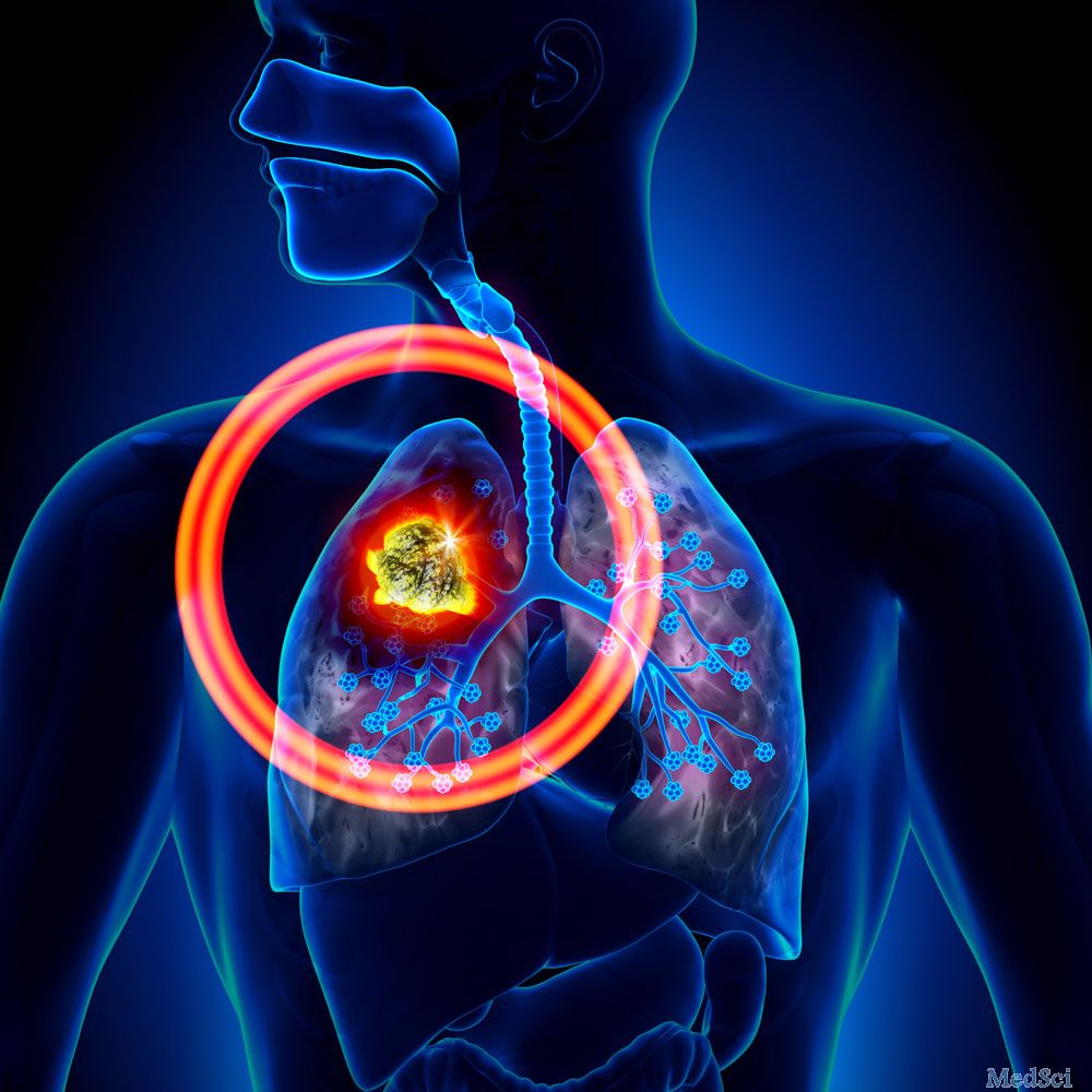 BJC：卡巴他赛治疗非小细胞肺癌研究