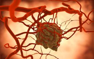 Cancer Res：具备两个属性让癌细胞易扩散