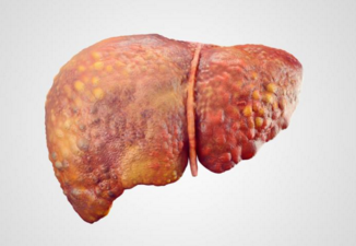 中美冠科生物开发出非酒精性脂肪肝疾病研究新模型