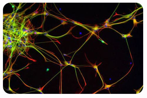 最新综述文章介绍干细胞疗法在神经疾病治疗方面的进展