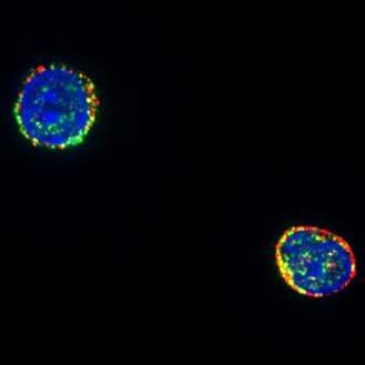 Cell<font color="red">子</font>刊：靶向作用休眠状态的HIV彻底攻克艾滋病