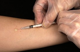 CMAJ：百日咳疫苗的有效性仅能维持数年