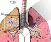 【盘点】近期非小细胞肺癌研究进展一览