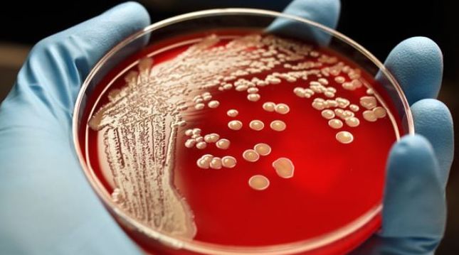 面对日益严峻的细菌耐药性形势 我们该如何应对？