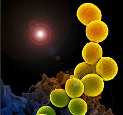J Intern Med：减少心血管事件，金黄色葡萄球菌是如何做到的？
