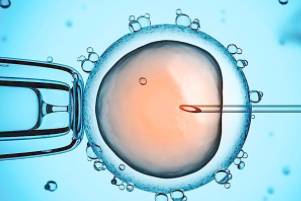 Hum Reprod：卵巢刺激性和非刺激性IVF对新生儿活产率和围生期结局有影响吗？