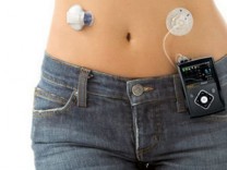 1型糖尿病福音：FDA批准首款自动给药设备