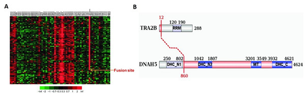 Cell Res：季红斌发现新的肺鳞癌致病融合基因TRA2<font color="red">B</font>-DNAH<font color="red">5</font>