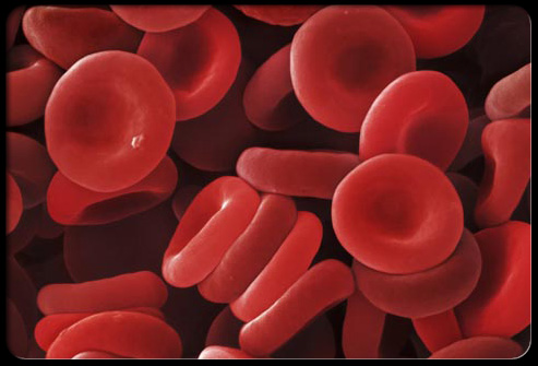 Circulation：结合珠蛋白和血红素结合蛋白可防止输入红细胞引起的不良效应