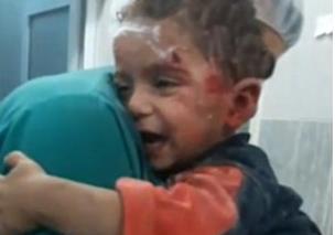 叙利亚遭空袭 孩子紧紧抱住护士感动众多<font color="red">网友</font>