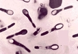 【盘点】近期艰难梭菌感染精选研究一览