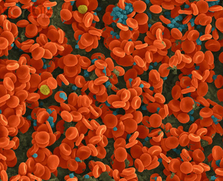 2015NICE技术评估指南——<font color="red">Idelalisib</font>治疗慢性淋巴细胞白血病（TA359）发布