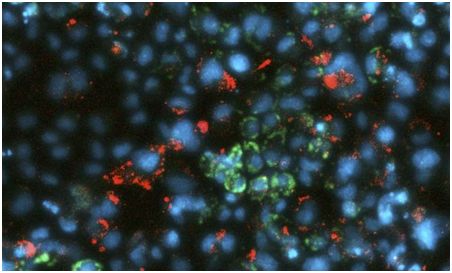 Nat Cell Biol：挑战常规！发现人肝细胞抵抗HCV感染的代谢过程
