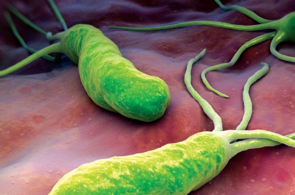 Lancet：治疗幽门螺杆菌，哪家强？